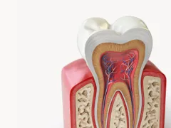 Desvitalização de Dentes