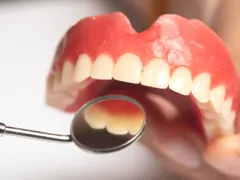 Próteses Dentárias Removíveis