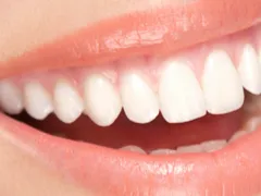 Tratamento das gengivas, osso e tecidos